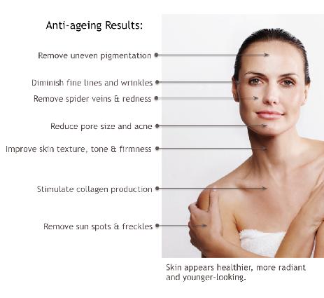 Best Selling IPL Hair Removal/Skin Rejuvenation/Vascular Removal Machine NBW-I323