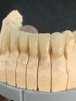 Bloque dental dental translúcido de la circona del espacio en blanco 3D de la circona del OEM favorable