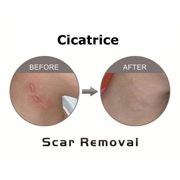 F7+ 30W RF Tube co2 fractional Laser vaginal tighten and skin rejuvenation machine