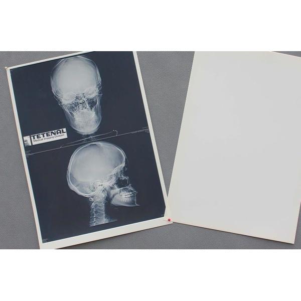 High Sharpness Xray Paper Films , Agfa Dt2b Fuji Medical Thermal Films