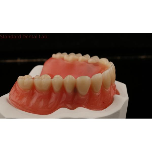 Dentsply Lucitone 199 Acrylic Denture For Full Arch Natural Look