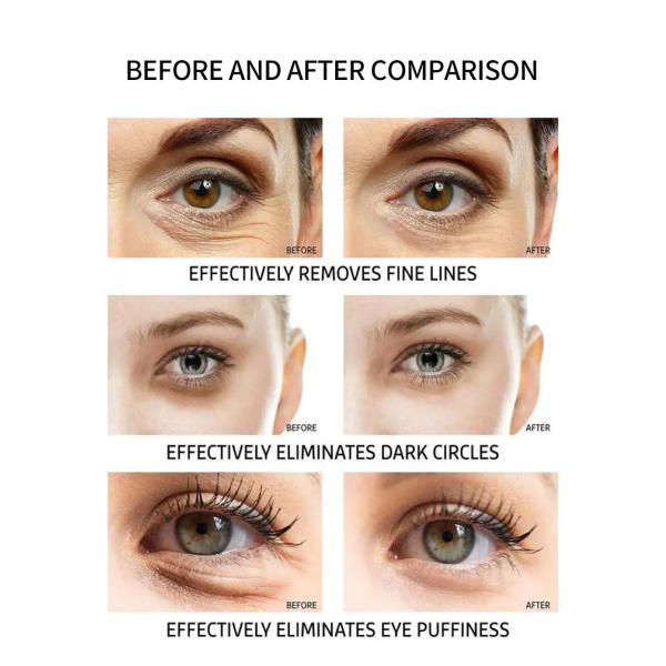 Customized Moisturizing Hyaluronic Acid Collagen Crystal Eye Mask Pad Whitening Biological