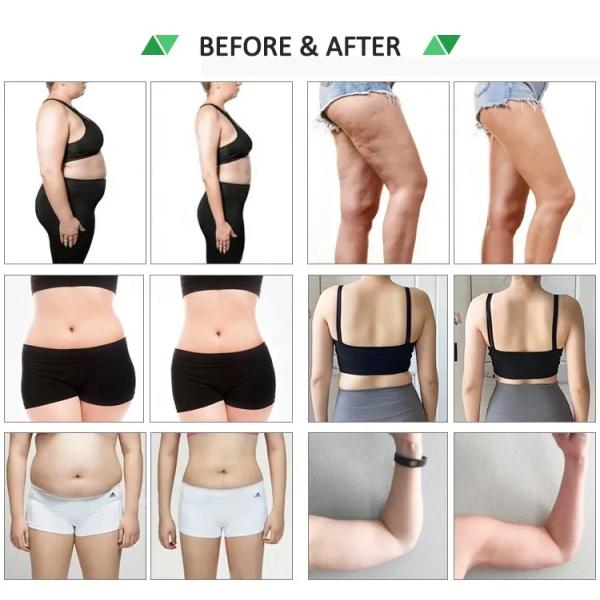 Эффективная мощная 10D Luxmaster Lipo Laser LLLT Машина для уменьшения жировых отложений