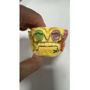 Orthodontic Treatment
