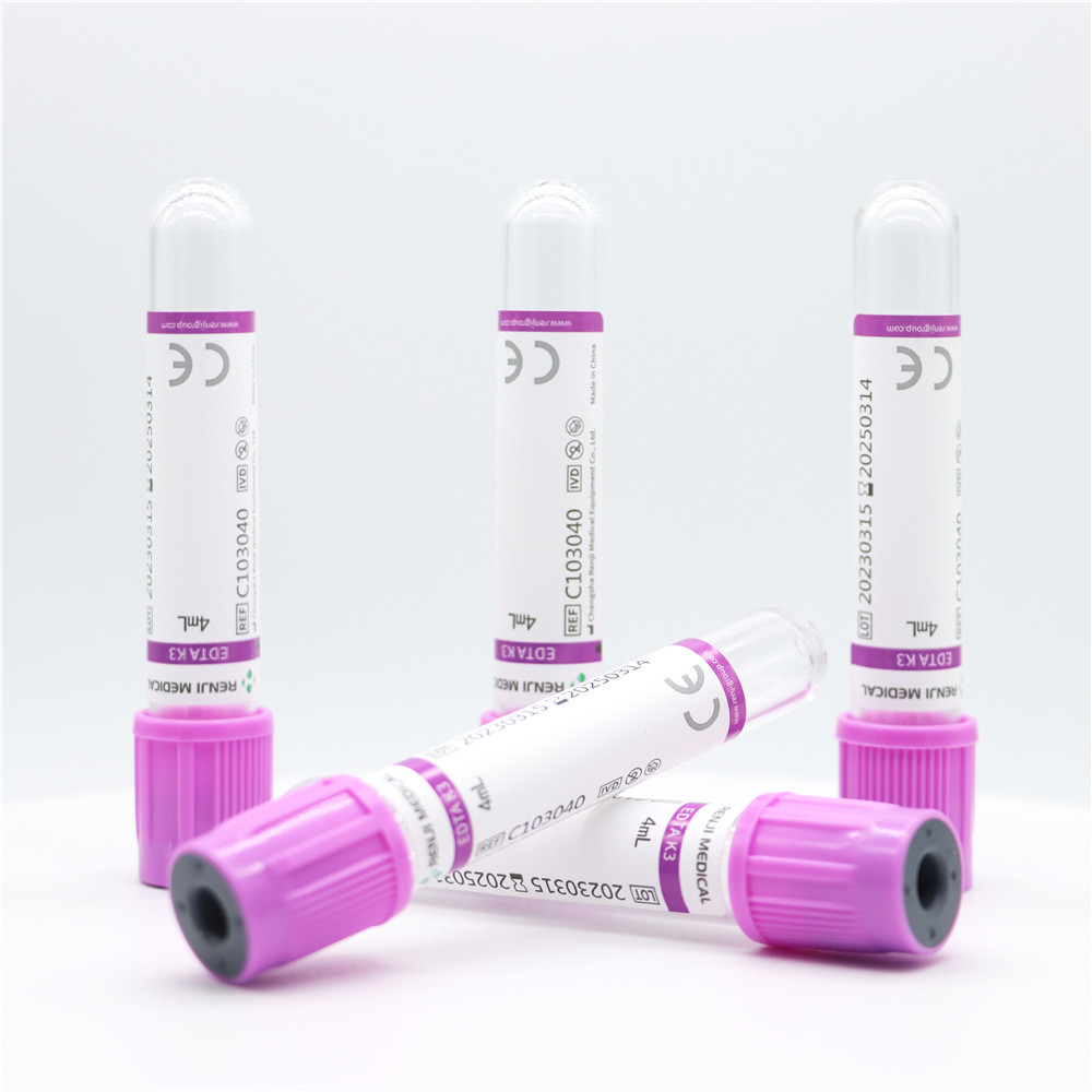Best Price Vacuum Tube Supplier EDTA &NaF Glucose Tube Blood Collection Tube