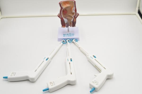 No Complications Stapler Treatment For Piles / Internal Hemorrhoids Short Recovery Time