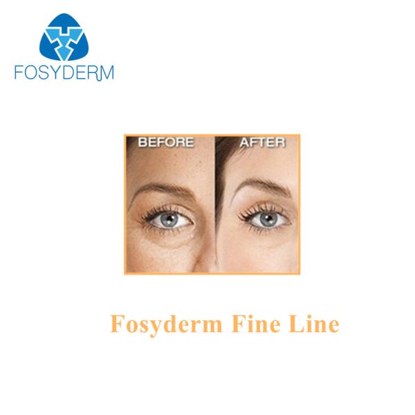 Крест Фосйдерм соединил кислоту тонкой линии заполнителя 2мл ХА Хялуроник для морщинок глаза