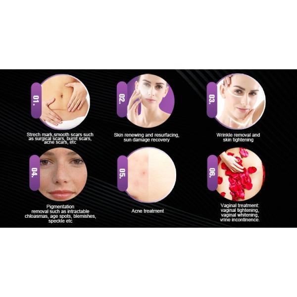 кожа лазера СО2 машина/50В красоты лазера 10600нм частичная Ресурфасинг