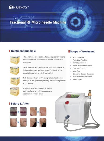 2016 Newest fractional rf/fractional rf microneedle/fractional rf micro needle machine