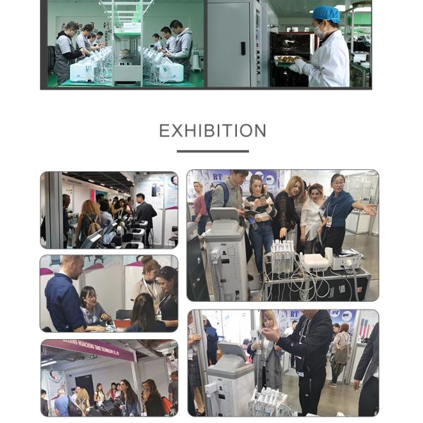 Услуги по удалению татуировок с помощью лазерной машины Q Switched Nd Yag