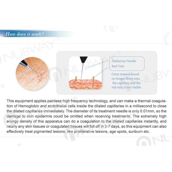Treatment pen only 0.01mm,with good epidermis protection and immediate telangiectasia sealing