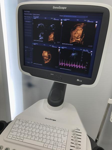 Sonoscape S12 Maquina De Ultrasonido Ultrasound Portable Ecography Machine