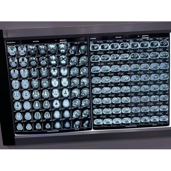 Película automática de densidad de rayos X para equipos médicos