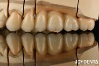Zirconium blanc avec une résistance élevée aux chocs thermiques