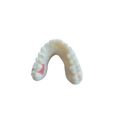 Digital Oral Scanning PFM Dental Crowns Bridge Implantology Demands