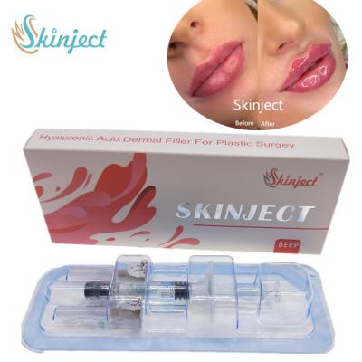 Skinject Deep Hyaluronic Acid Dermal 2ml Lips Fillers Injectable