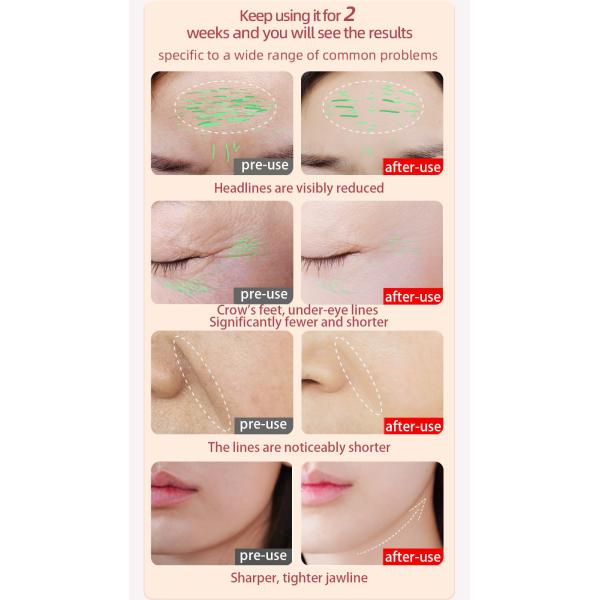 46G Warming Anti Aging Eye Massager Pen Wand for Face Neck Eyes Body EMS Microcurrent