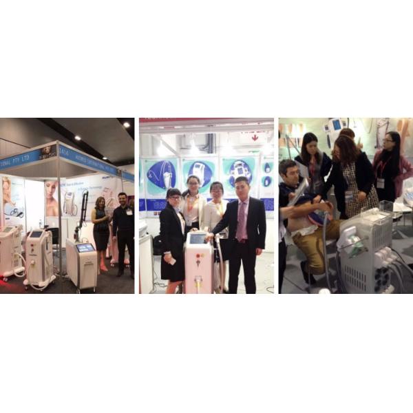 Машина удаления волос лазера диода удаления 808nm волос equipmemnt красоты продажи продвижения постоянная для продажи