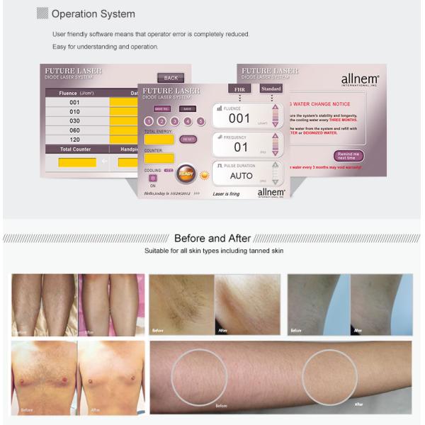 Salon Beauty 808nm Diode Laser Hair Removal Machine 10 - 400ms Pulse Duration