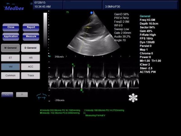 Ce/ISO 4D Color Doppler Ultrasound Diagnostic System Scanner Machine