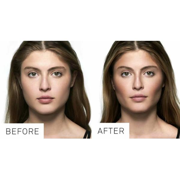 Revitalizing Hyaluronic Acid Face Filler By Revolax For 6-12 Months Of Youthful Radiance