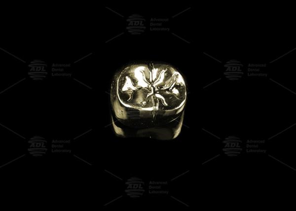 Sleek Full Cast Metal Crown Precious Alloy Gold 20% Polished Full Metal Dental Crown