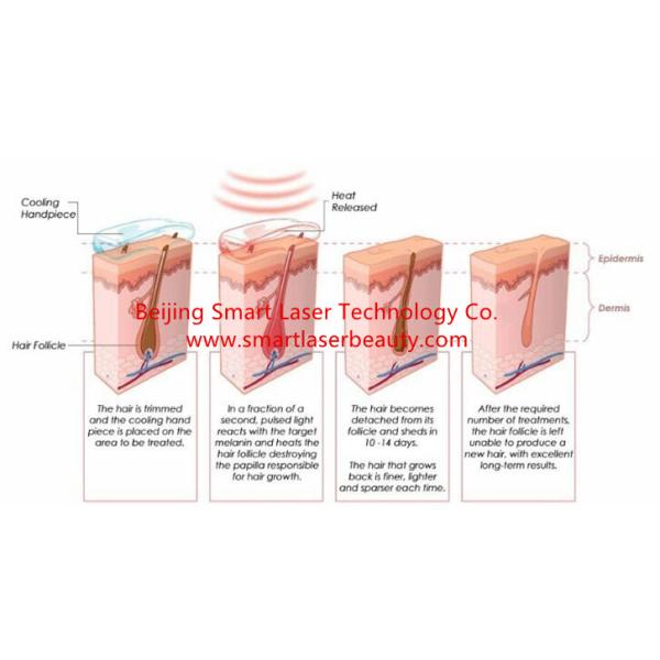 Dual Handles SHR IPL Hair Removal Machine For Skin Rejuvenation , Freckle Removal