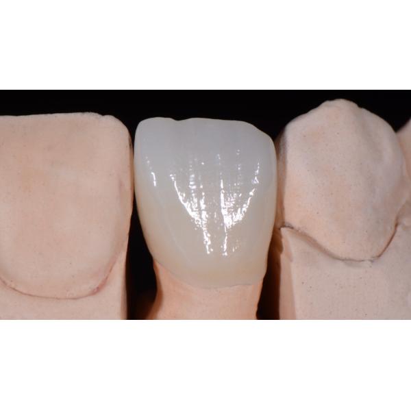 Pre Shaded CAD CAM Dental Zirconia Blocks 1100 Mpa C2 D98*10mm
