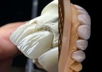 Dentes duradouros, coroa de zircônio sólida, dentes de coroa precisos, laboratório de circônio.