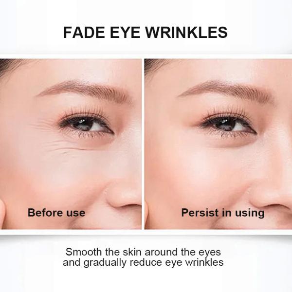 Regeneración Ácido ascórbico Retinol Crema para ojos intensa para ojeras Blanqueamiento antienvejecimiento