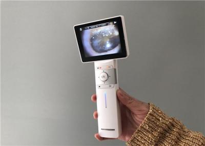 Otoscope video Dermatoscope de Digitas e espaços gerais da inspeção da imagem latente com 3,5 cor completa TFT LCD