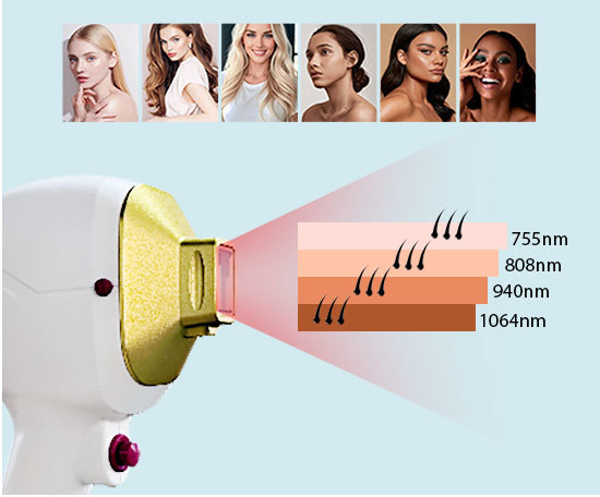 755nm 808nm 1064nm Diode Laser Hair Removal System With AI Smart Handle