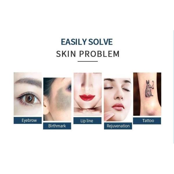 Nd Yag Laser Skin Rejuvenation Picosecond Machine for Tattoo Removal and Skin Whitening