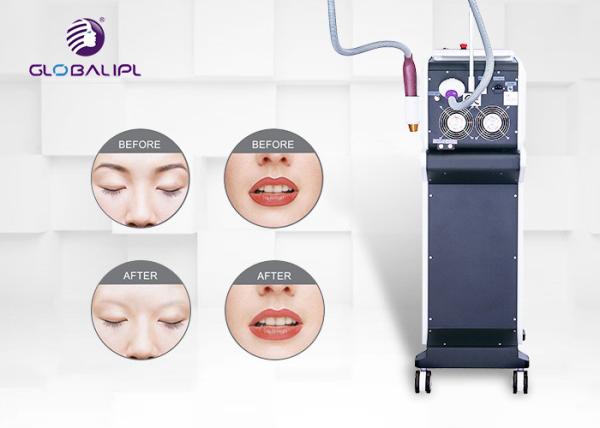 Safety Pico Second Laser Machine For Tattoo Removal Pigment Removal