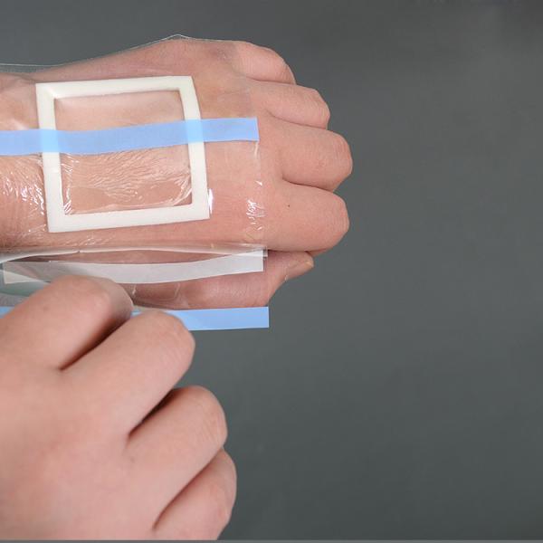 Medical waterproof transparent wound dressing adhesive pad silicone wound dressing border