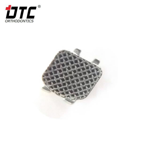 DTC Bright Series Metal Brackets The Key to Successful Class II Orthodontic Treatment