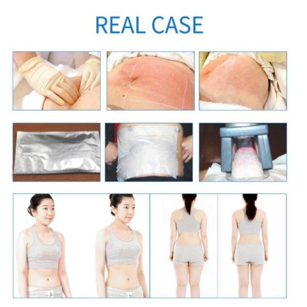360 Body Shaping / Cryolipolysis Slimming Machine With 5 Working Handles