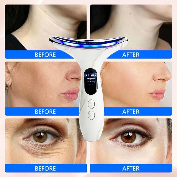 7 in 1 Face Lift Device Anti-Wrinkle and LED Facial Massage Tool for Skin Rejuvenation