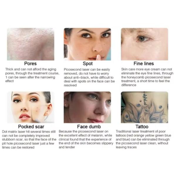 Máquina láser IPL de 808nm ND YAG multifuncional vertical para depilación y cuidado de la piel