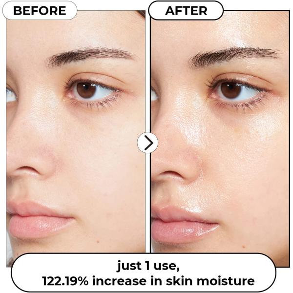 Tónico hialurónico Arroz Agua Rosa Humectante Tónico Control de aceite Hidratante Tónico facial