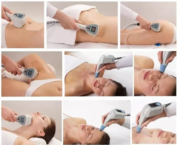 Portable 2-In-1 RF Ultrasonic Machine For Face Lifting & Eye Firming