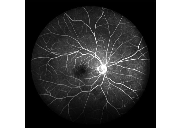 Оборудование камеры Fundus сканирования лазера профессиональное офтальмическое с Fundus отображая размер зрачка FOV 160° минимальный 2 mm
