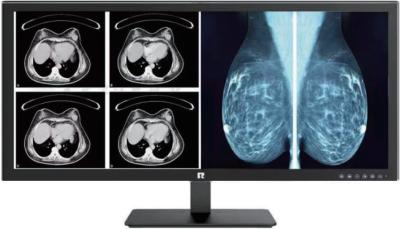 High-Definition Medical Display with DICOM Compliance for Radiology Grade Imaging