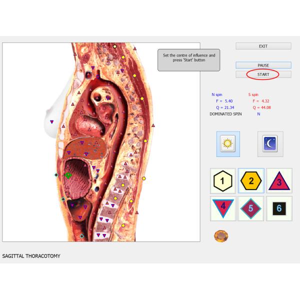 Clinical Examination Aids Full Body Health Analyzer 8d Nls Health Analyzer