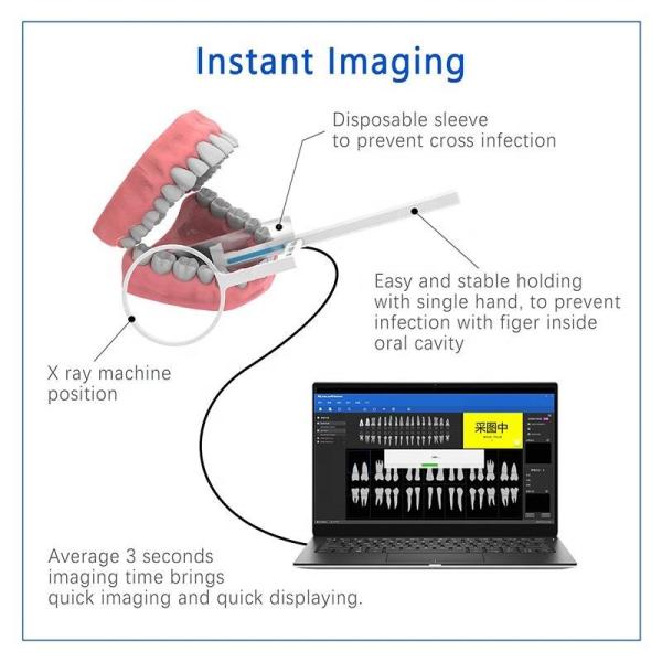 Máquina Odontológica de Raio-X Multiuso USB, Unidade de Raio-X Odontológica Portátil Sem Fio