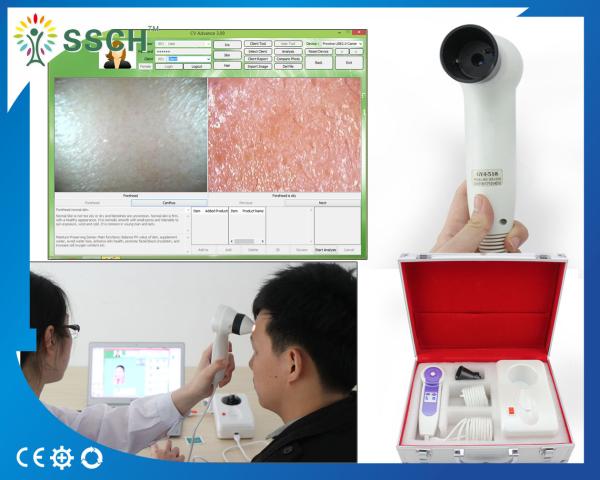 Função e segurança do analisador facial do espaço da pele da máquina do analisador da umidade da pele multi