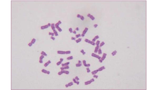 1 flacon*100 ml Giemsa Stain Pour la cytologie Appareils médicaux largement utilisés