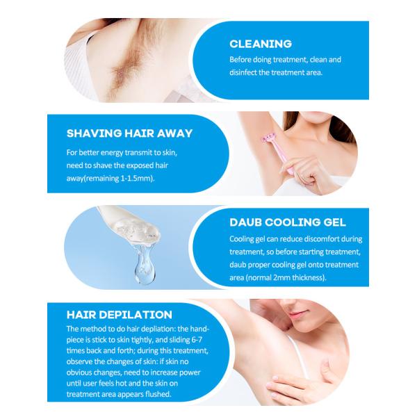 2000W Skin Rejuvenation Painless Hair Removal 808nm Diode Laser Machine