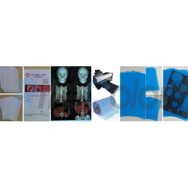 Фильм медицинского отображения рентгеновского снимка ЛЮБИМЦА высокого разрешения голубой для общих струйных принтеров