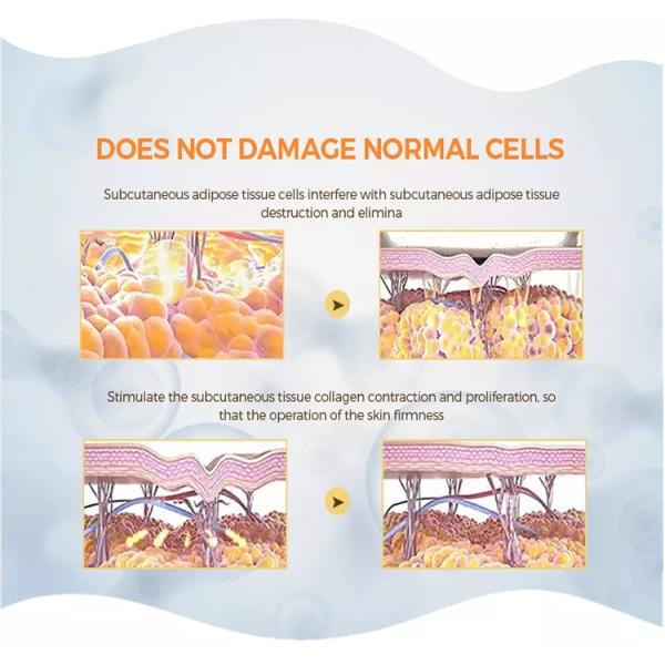 Tecar Shock Wave Machine Multifunction Pain Relief Rf Portable Beauty St09